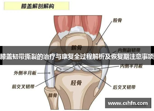 膝盖韧带撕裂的治疗与康复全过程解析及恢复期注意事项